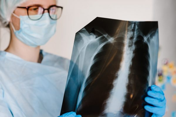 doctor-specialist-pulmonary-medicine-holding-radiological-chest-x-ray-film-for-medical-diagnosis-on-patient-health-on-infected-coronavirus (1)